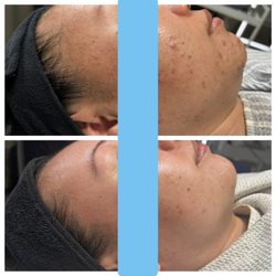 Clear Skin Solutions