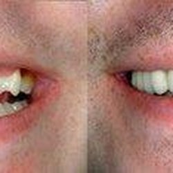 Acton Family Dental Care