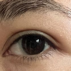 Miller Optometry - Before and after stye
