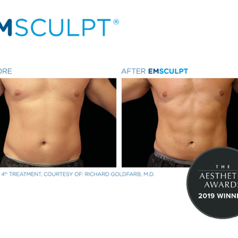 FRINGE IQ - 20,000 crunches in 30 minutes? Done. No surgery, no downtime, no sweat. EmSculpt in 4 treatments with results in less than 6 weeks!! - Hair Loss Centers Near Me - Calabasas, California FRINGE IQ - 20,000 crunches in 30 minutes? Done. No surgery, no downtime, no sweat. EmSculpt in 4 treatments with results in less than 6 weeks!! - Hair Loss Centers Near Me - Calabasas, California