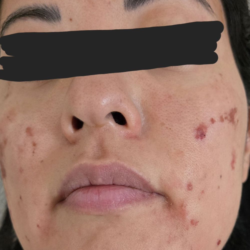 Oculofacial Plastic Surgery Hawaii - DISFIGURED MY FACE AT DR. LEES OFFICE - Cosmetic Surgeons Near Me - Honolulu, Hawaii Oculofacial Plastic Surgery Hawaii - DISFIGURED MY FACE AT DR. LEES OFFICE - Cosmetic Surgeons Near Me - Honolulu, Hawaii