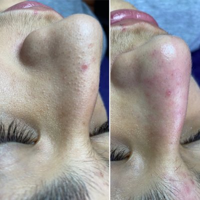 Mirame Skin Treatments by null