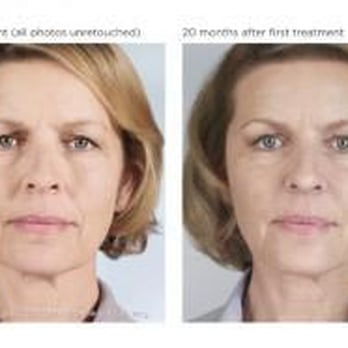 Esta Kronberg, MD - Dermatologists Near Me - Houston, Texas
