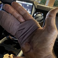 Munson Medical Center - Traverse City - Repaired finger by an amazing surgical team!