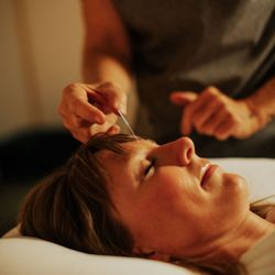 Desert Healing Medical Spa - Acupuncture
