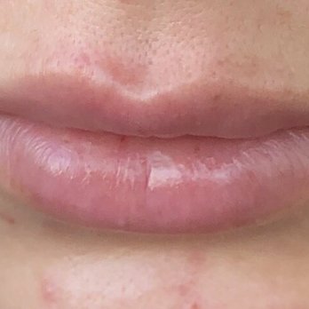 Beauty Lab + Laser Med Spa | Murray - Medical Spas Near Me - Murray, Utah Beauty Lab + Laser Med Spa | Murray - Medical Spas Near Me - Murray, Utah