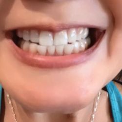 Diamond Dental - Super clean teeth- 5/23/25- thank you Dr Kha and Michelle