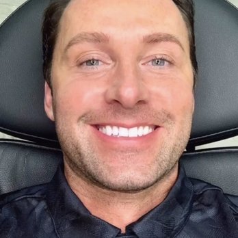 The Guy Brow - Almost finished with my session - Permanent Makeup Near Me - Newport Beach, California
