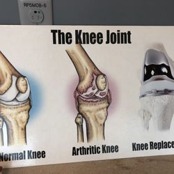 Massage 4 Life by Kim Alvarado - Kim has been a huge help getting me back to my regular activities after bi-lateral knee replacement.
