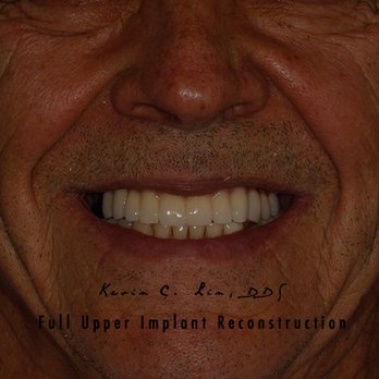 Kevin C Lin, DDS, FACP - Prosthodontists Near Me - Sunnyvale, California