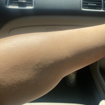 West U Laser - the few hairs that grow back now are so thin and light they're basically invisible - Laser Hair Removal Near Me - Houston, Texas West U Laser - the few hairs that grow back now are so thin and light they're basically invisible - Laser Hair Removal Near Me - Houston, Texas