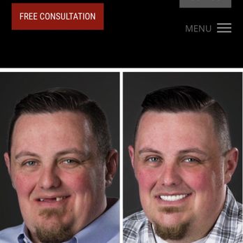 Barker Dentistry & Implant Center - Before and After - Cosmetic Dentists Near Me - Conroe, Texas Barker Dentistry & Implant Center - Before and After - Cosmetic Dentists Near Me - Conroe, Texas