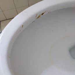 Bloody shit on the toilet!!!