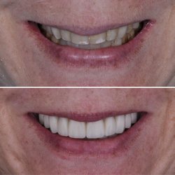 West Seattle Smile