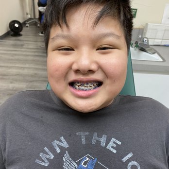Derek Wong, DDS MS - Wong Orthodontics - Amazing work! My son was not in any pain and experience 1-2 days of soreness (which is normal). - Orthodontists Near Me - Alhambra, California Derek Wong, DDS MS - Wong Orthodontics - Amazing work! My son was not in any pain and experience 1-2 days of soreness (which is normal). - Orthodontists Near Me - Alhambra, California