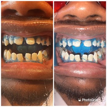 BabyCakez - Teeth Whitening Near Me - Antioch, California BabyCakez - Teeth Whitening Near Me - Antioch, California