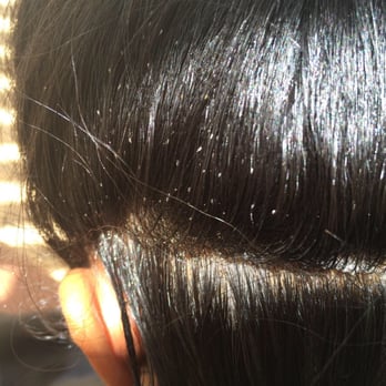 These Are Lice Eggs That Need To Be Handpicked And Combed Out Yelp