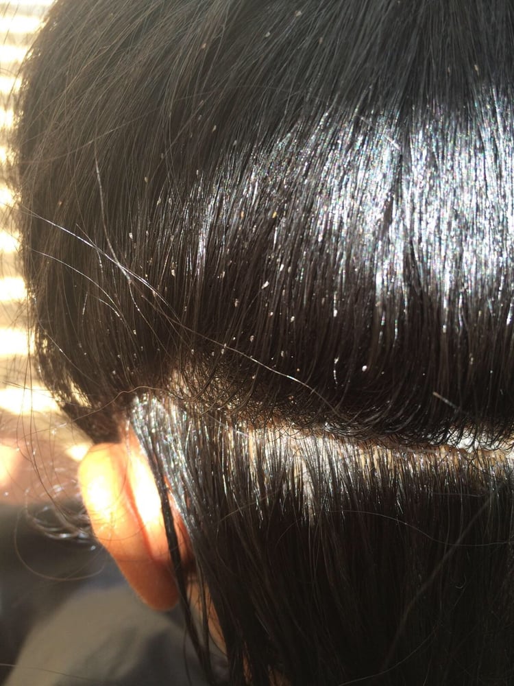 Los Angeles Head Lice Treatment 27 Photos Lice Services