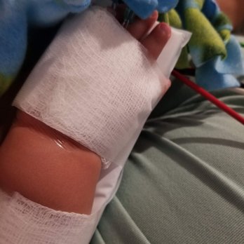 St. Cloud Hospital - The nurses here made a nice brace to prevent his IV from coming out. - Medical Centers Near Me - St. Cloud, Minnesota St. Cloud Hospital - The nurses here made a nice brace to prevent his IV from coming out. - Medical Centers Near Me - St. Cloud, Minnesota