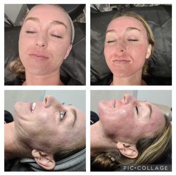Renati Med Spa - Medical Spas Near Me - Cypress, Texas Renati Med Spa - Medical Spas Near Me - Cypress, Texas