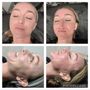 Photo of Renati Med Spa