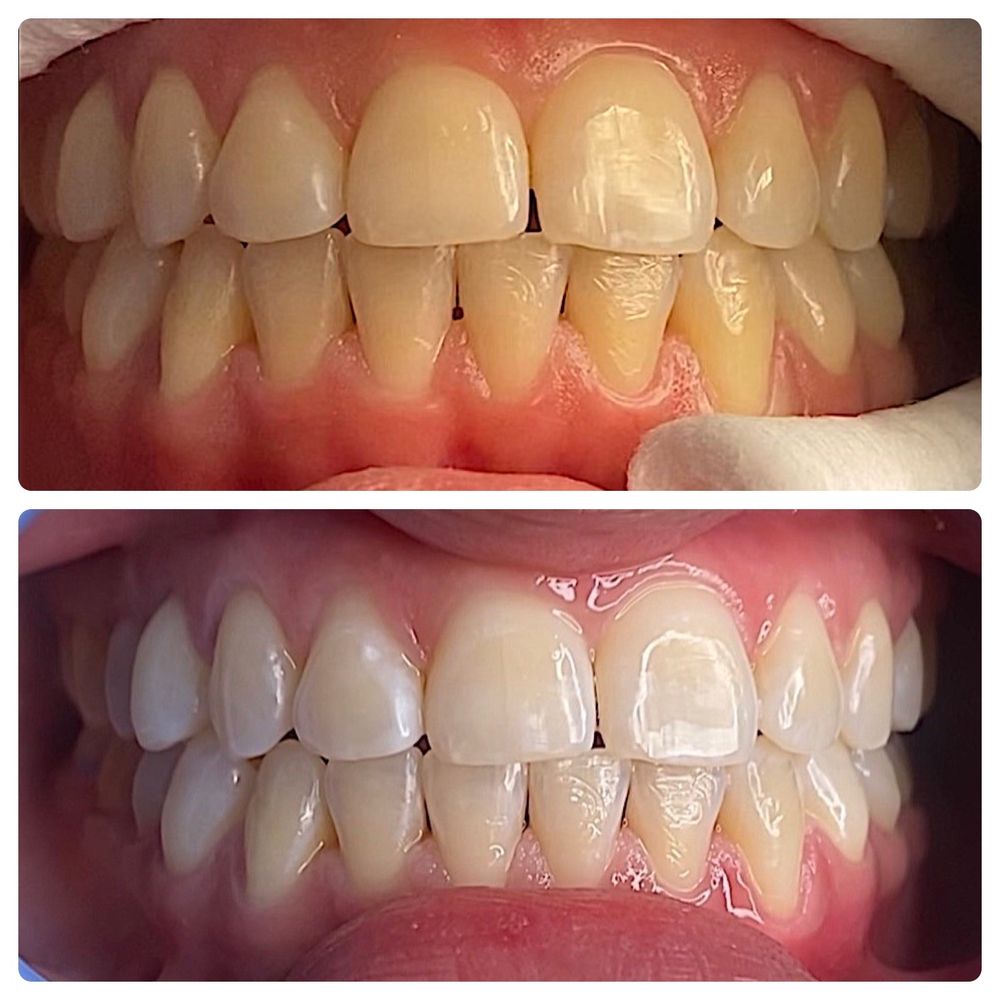 Smiles By Gustavo Logo