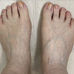 Chau's Nails - After regular pedicure!