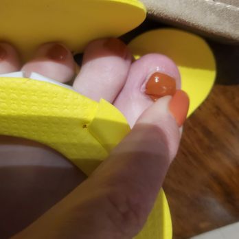 1st Nails - One side of toenail totally missed with polish - Nail Salons Near Me - Austin, Texas