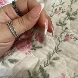 Chipped nails