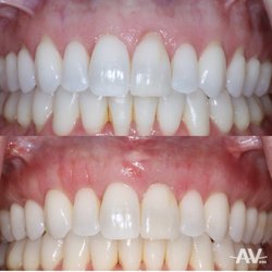 Andrew Verrett- Austin Periodontal Associates