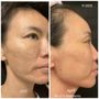 Photo of Visage Laser &  Skin Care