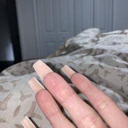 Bottom of finger also cut Bottom of finger also cut