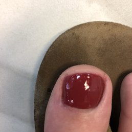 Post pedicure - can't even tell the nail is broken and there was no pain and I am no longer embarrassed by my toe Post pedicure - can't even tell the nail is broken and there was no pain and I am no longer embarrassed by my toe
