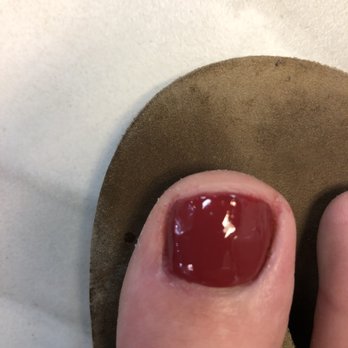 DB Nails & Eyelash Extensions - Post pedicure - can't even tell the nail is broken and there was no pain and I am no longer embarrassed by my toe - Nail Salons Near Me - Castle Rock, Colorado