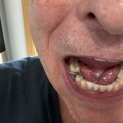North Jersey Oral & Maxillofacial Surgery