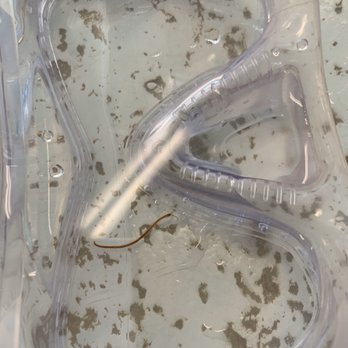 Staybridge Suites Columbus-Dublin - These are the insects that are swimming and thriving in this pool! - Hotels Near Me - Dublin, Ohio Staybridge Suites Columbus-Dublin - These are the insects that are swimming and thriving in this pool! - Hotels Near Me - Dublin, Ohio