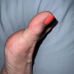 Serenity Nail Salon & Spa - Cut on toe