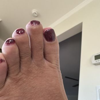 Avalon Nail Spa - Horrible pedicure! - Nail Salons Near Me - Napa, California