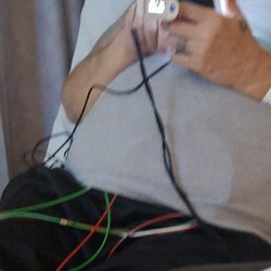Garden City Hospital - The cords were not attached to the device.. He didn't have a device for 14 hours. That is my pulse ox on his finger from home