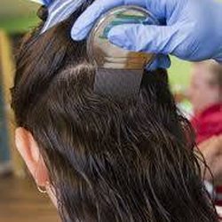 Organic Lice Guru