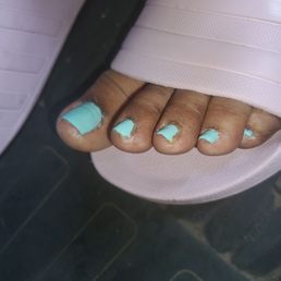Results of my pedicure