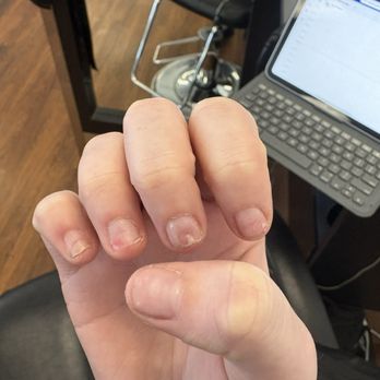 Nails By Triana - Before of right hand before I started seeing her - Nail Technicians Near Me