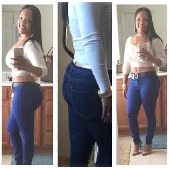Saul Lahijani, MD - My before buttocks -middle photo- 6 months post op. - Cosmetic Surgeons Near Me - Beverly Hills, California Saul Lahijani, MD - My before buttocks -middle photo- 6 months post op. - Cosmetic Surgeons Near Me - Beverly Hills, California