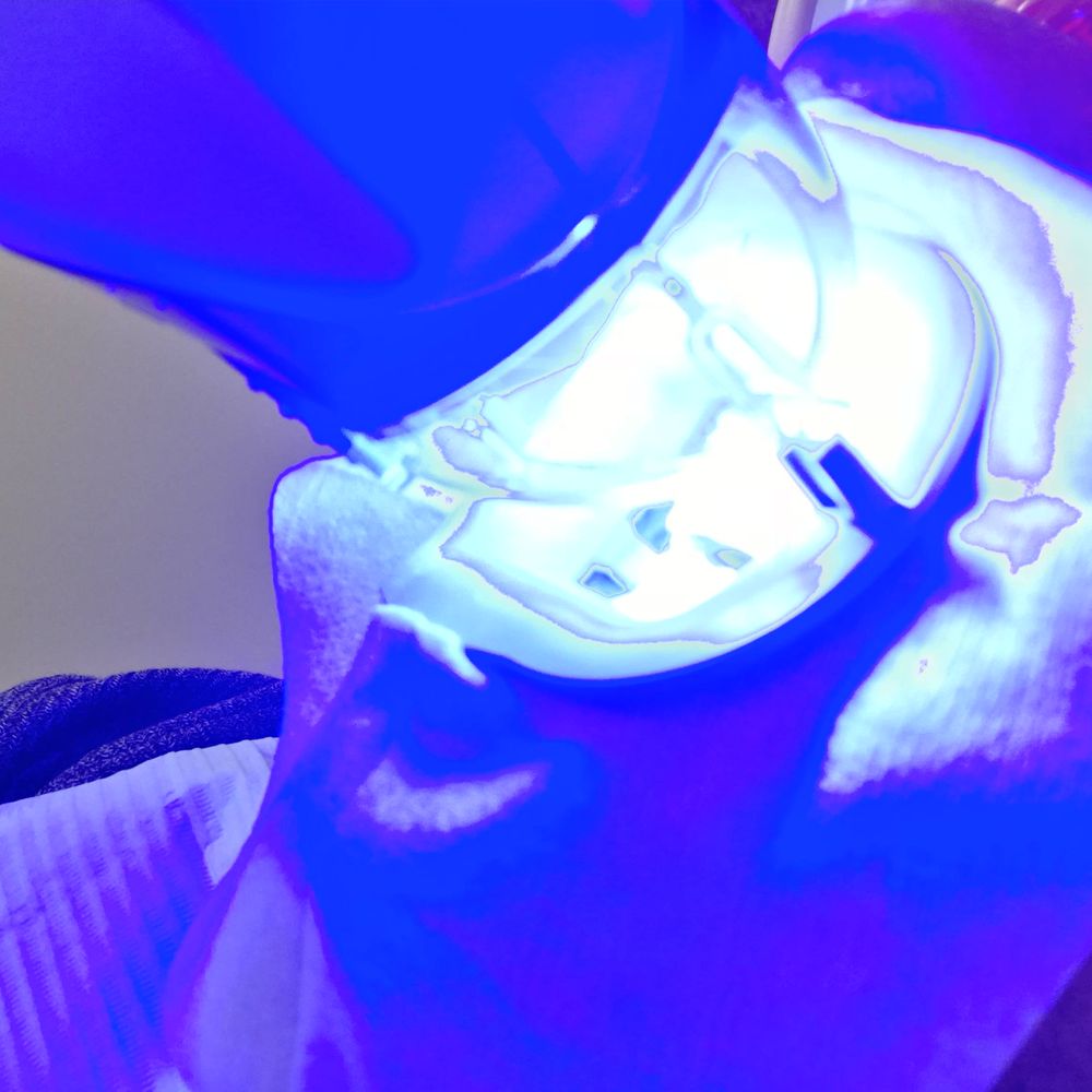 Dentistry On Thornhill Woods - Cool looking photo that I snapped - my iPhone did some funky effects I just had to share. The whole process is 100% PAINLESS! - Cosmetic Dentists Near Me - Vaughan, Ontario Dentistry On Thornhill Woods - Cool looking photo that I snapped - my iPhone did some funky effects I just had to share. The whole process is 100% PAINLESS! - Cosmetic Dentists Near Me - Vaughan, Ontario