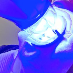 Dentistry On Thornhill Woods - Cool looking photo that I snapped - my iPhone did some funky effects I just had to share.  The whole process is 100% PAINLESS!