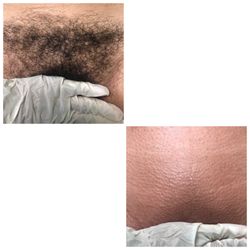 Perfect Paradise Facial & Wax Bar - Brazilian wax