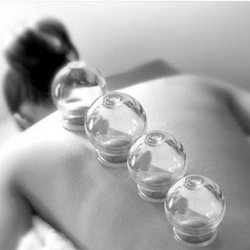 Art Of Healing Pains - FIre cupping
