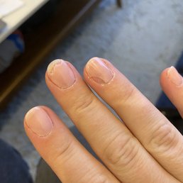 SNS chipped after 2 days SNS chipped after 2 days