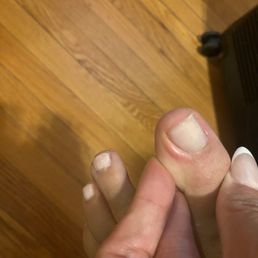 Also, aside from the infection, this isn't even a great pedicure. It's only been two days. Do better.