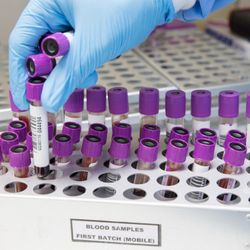 Feasy labs and Testing - Blood draw for any test